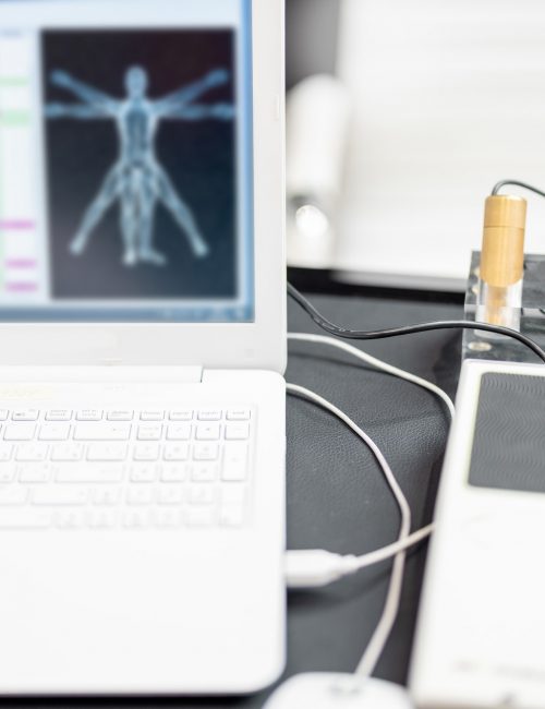 Bioenergetic testing device with brass handpieces in medical clinic